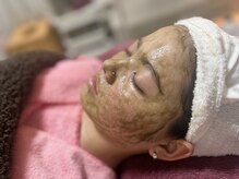 ルミナス(Luminous)/ハーブピーリング