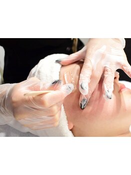 顔脱毛がしたい