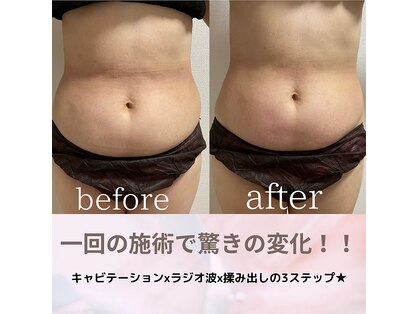 ムム(MooMoo)の写真