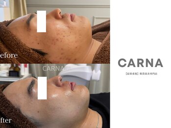 カルナ(CARNA)/【肌質改善専門店】CARNA