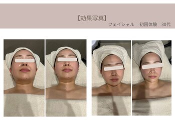 ミライ 福岡筑紫野店(mirai)/進化型フェイシャル体験