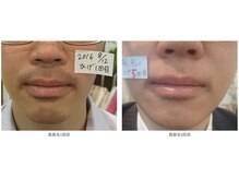 キャナ(CANA)の雰囲気（メンズのお髭脱毛のモニターさん大募集中です＊）