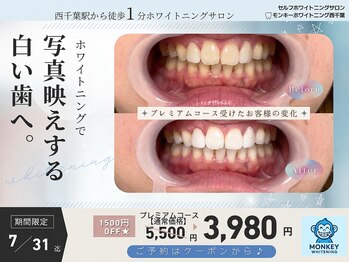 モンキーホワイトニング 西千葉の写真/【西千葉駅徒歩1分☆】歯のホワイトニング・セルフホワイトニング店！【完全個室】写真映えする白い歯へ♪