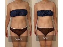 ヨサパーク こらっしぇ御徒町店(YOSA PARK)/短期集中!ラストダイエット