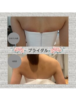 ディア スプリーマ/ブライダルエステ★8回目の効果