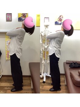 ヒデ整体院(Hide整体院)/猫背矯正骨盤矯正B/A肩こり腰痛