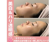 ラグーナ(Laguna)の雰囲気（圧倒的美白・透明肌☆タラソトリートメントで肌のハリツヤUP！）