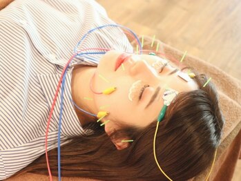レゴリスの写真/ブライダル前撮り前にも◎【多鍼電気美容鍼¥6600】小顔矯正付☆ほうれい線/たるみケア/左右差/リフトアップ