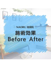 ナオル整体 池袋院(NAORU整体)/肩の歪み調整！【池袋駅 整体】