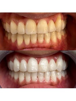 コナホワイトニング 神保町/セルフホワイトニング御茶ノ水