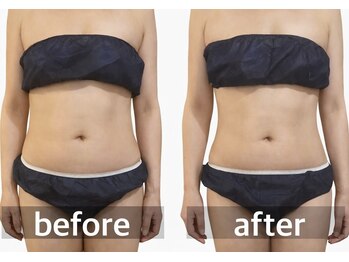 リムアール(Limh R)/