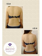 プライベートエステティックサロン アメジスト(AMETHYST)/継続のお手入れが効果的です。