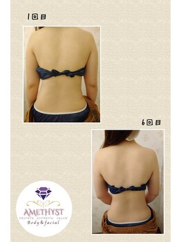 プライベートエステティックサロン アメジスト(AMETHYST)/継続のお手入れが効果的です。