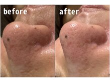 ウールー(Heureux)/芸能人・モデル御用達♪