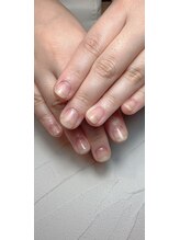 スマイルニコ(smile nico)/深爪矯正で爪再生のお手伝い