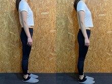 クリアリティ ボディ ケア(clearity body care)/体験後のビフォー＆アフター♪