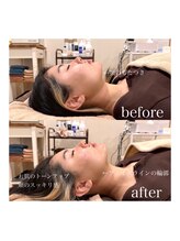 ライム 松本(LIME)/《Hi-UP＊顎下/二重あご改善》