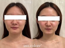 リノコロレ(ino.colore')/【人気No.1小顔コルギ】×5回