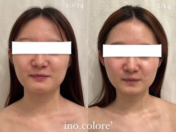 リノコロレ(ino.colore')/【人気No.1小顔コルギ】×5回