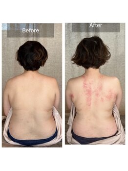 メゾンドメリッサ(MAISON de MELISSA)/