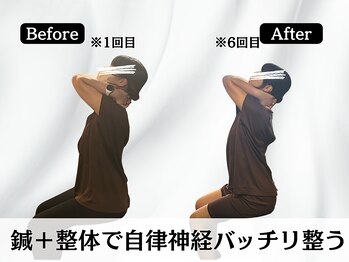 ハリユナイテッド 原宿鍼灸 整体院(HALI UNITED)/自律神経整え、疲れない体へ!