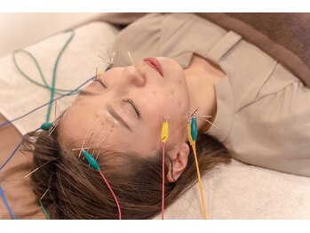 ハルユイ(haruyui)/アプローチ法が違う選べる美容鍼