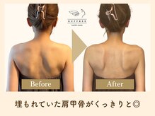 ラフリー 八丁堀院(RUFFREE)/埋もれていた肩甲骨復活【広島】