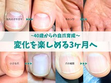 キラリネイル(KIRARINAIL)