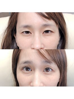 アイビューティー(AI beauty)/ラッシュリフト