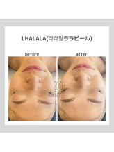 ポムハヌル(pom.haneul)/韓国肌管理室