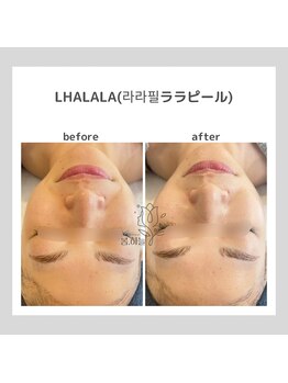 ポムハヌル(pom.haneul)/韓国肌管理室