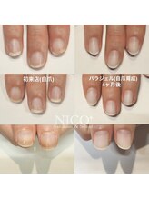 ニコプラス(NICO+)/自爪育成中