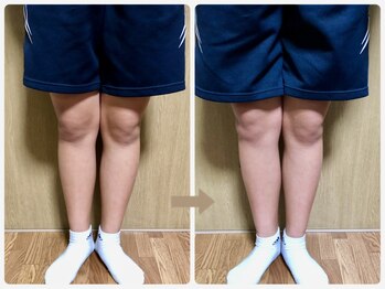 哲心 姫路/О脚が気にならなくなりました♪