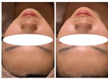 プライベートサロン 美月/ツヤ肌　毛穴レス肌