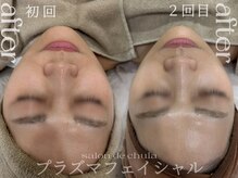 サロンドチュラ(salon de chula)/プラズマ/韓国美容液導入
