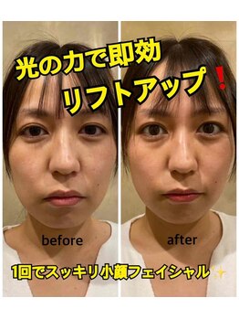 リズベット(LIZ BET)/最強★魔法のパワーライト！