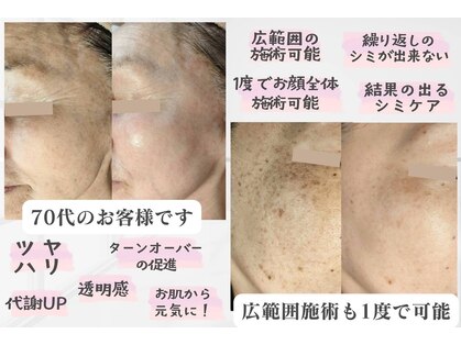 モモイロ(momoiro)の写真