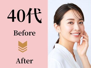 アメリイ 百合ヶ丘 新百合ヶ丘(Amerii)/【40代】ダイエット痩身の実績