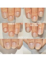 ニコプラス(NICO+)/自爪育成中