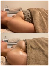 美人バスト 札幌店/バストアップ×育乳 &nbsp;◇症例◇