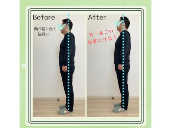 フェリコル さいたま新都心 与野駅前店(Felicol)/【お客様B/A】腰痛改善☆姿勢◎