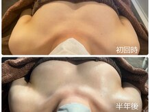 アイリィー(irie)の雰囲気（流れ左右差、下垂などのお悩みにも◎）
