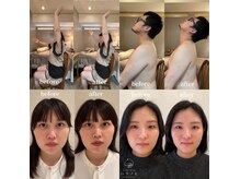 たるみ・むくみ・猫背・巻き肩・肩こり・四十肩・眼精疲労が改善