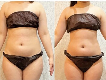 美容整体ウェリナ あま甚目寺院/小顔矯正/骨盤矯正/美脚サロン