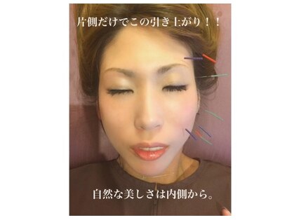 ビシンボディー 武蔵小杉新丸子店(Bishin Body)の写真