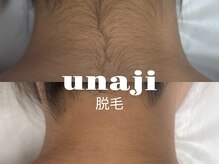 ラティエ(Latier)/うなじ脱毛