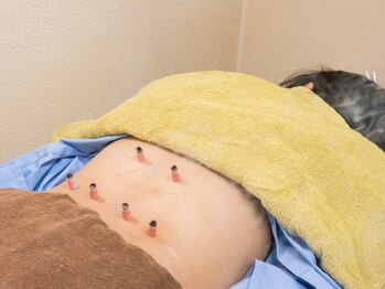 いなほ はりきゅう整骨院 東新宿/腰痛にも/東新宿