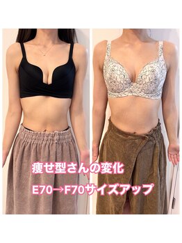 リソラ(risora)/痩せ型さんの変化