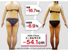 セントラヴィ 川崎店/Before After【20代女性(3)】