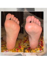 バリスパアラミー(balispa Alami)/生理不調・肩こり・冷え